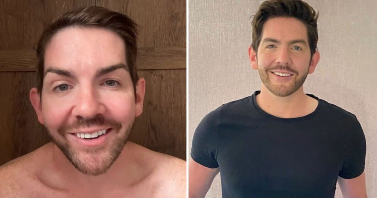Gavin & Stacey star sees &#039;baby hair sprouting&#039; after taking hair supplements