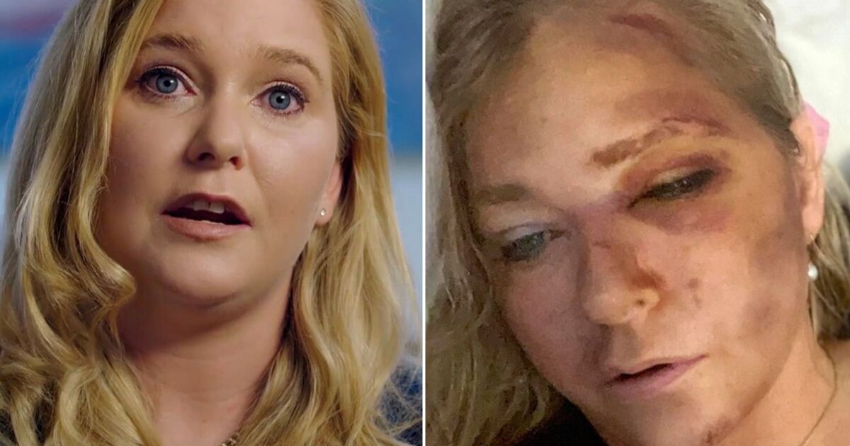 Prince Andrew accuser Virginia Giuffre faces court as she recovers from bus crash