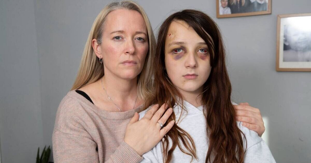 Girl, 16, admits beating autistic girl, 12, in grim skatepark attack