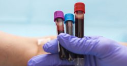 Revolutionary blood test can detect common cancers with 99% accuracy — UK trial launched